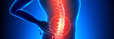 https://www.pssmwellness.com/conditions/back-pain/