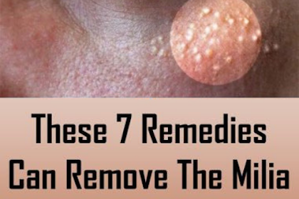 These 7 Remedies Can Remove The Milia (Milk Spots) From Your Face