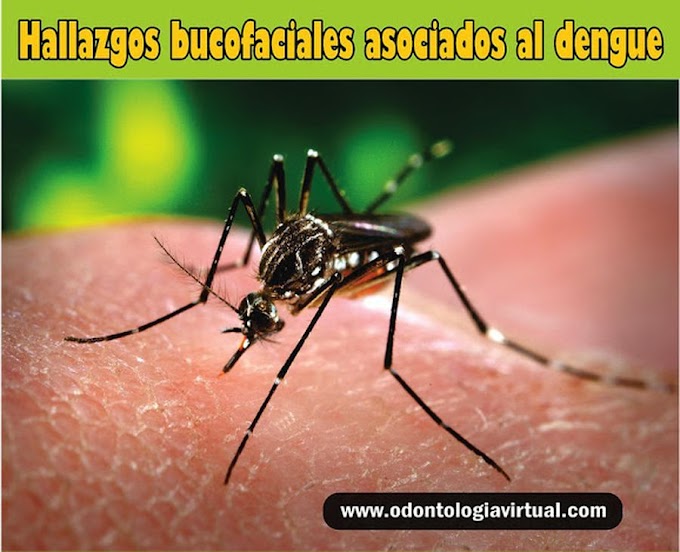 PDF: Hallazgos bucofaciales asociados al Dengue