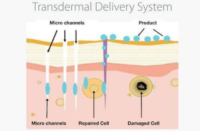 Metode Pengobatan Transdermal dengan Varash Healing Oil