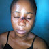 Polytechnic Lecturer Flees After Injuring A Female Student {Photos}