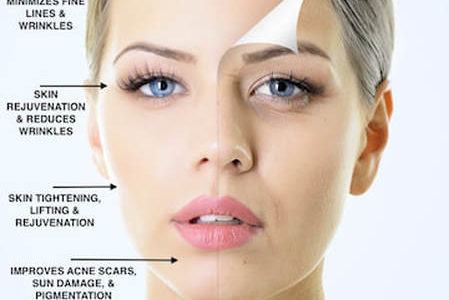 PRP Skin Rejuvenation