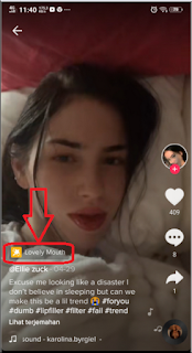 Lip Filler filter Tiktok  - How to Find and Get Lip Filler Filters in TikTok