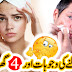 How To Get Rid Of Acne - Home Remedy