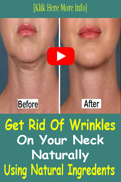 How To Get Rid Of Wrinkles On Neck