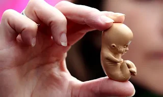 Abortos: em 2024, mais de 45,1 milhões de bebês foram mortos