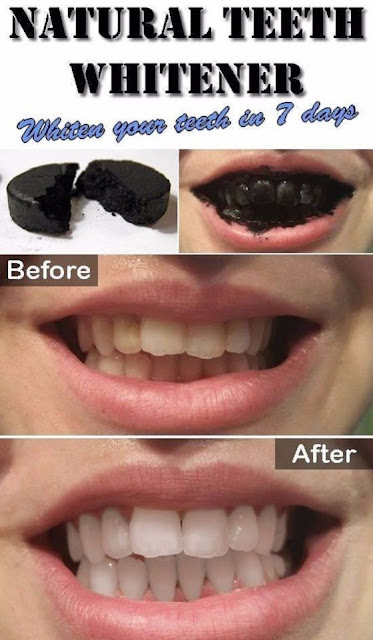 Natural Teeth Whitener 