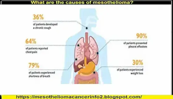 What Everyone Must Know About MESOTHELIOMA CANCER SYMPTOMS