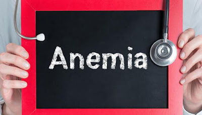 Foods for Treating Iron Deficiency Anemia and Side Effects