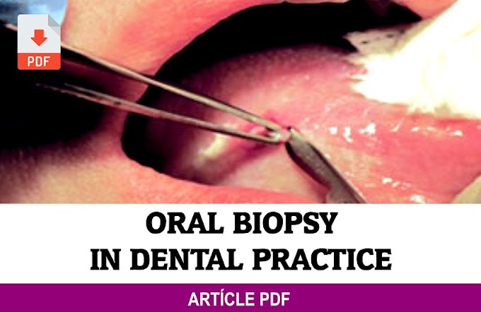 PDF: Oral Biopsy in dental practice