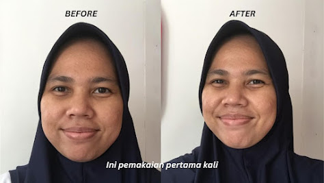 Foto Before-After pemakaian Scarlett Sun Bright Daily Sunscreen