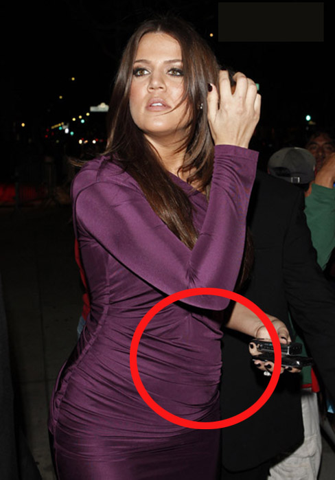Khloe Kardashian Pregnant