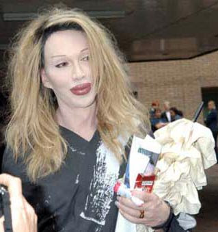 Pete Burns Awful Lips Surgery