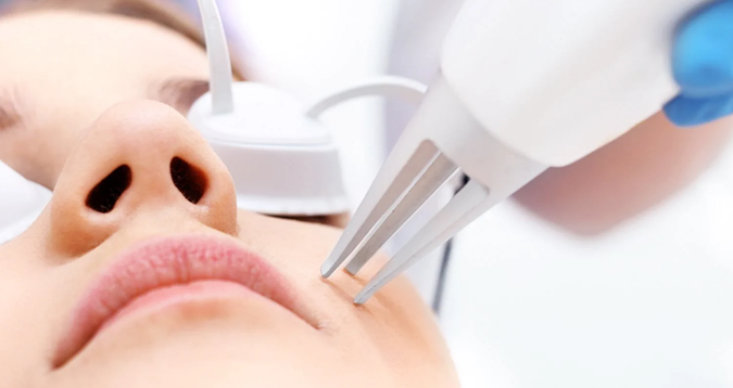 Laser Treatment - Purpose, Types, and Procedures