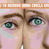 how to remove dark circle permanently-Bengali dark circles under eyes treatment