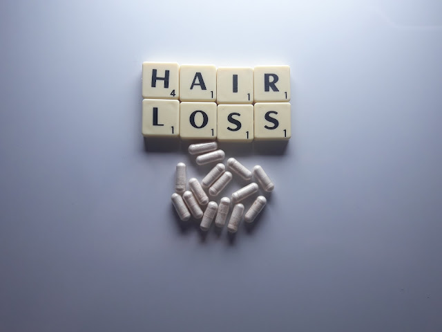 Excessive hair loss - 5 Things you must avoid