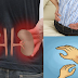 Early Dangerous Symptoms Of Kidney Failure You Probably Didn't Know