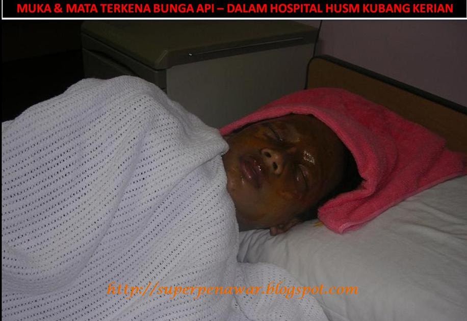 RAJA SEGALA PENAWAR: MUKA & MATA TERKENA BUNGA API