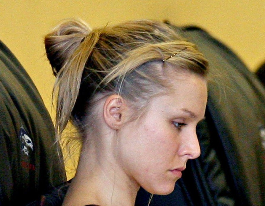 Kristen Bell is rarely spotted with acne pimples perhaps because they 