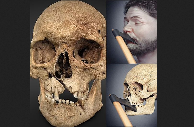 Researchers reconstruct the face of a 14th-century warrior from 1361, unveiling the countenance of a medieval hero through meticulous analysis.