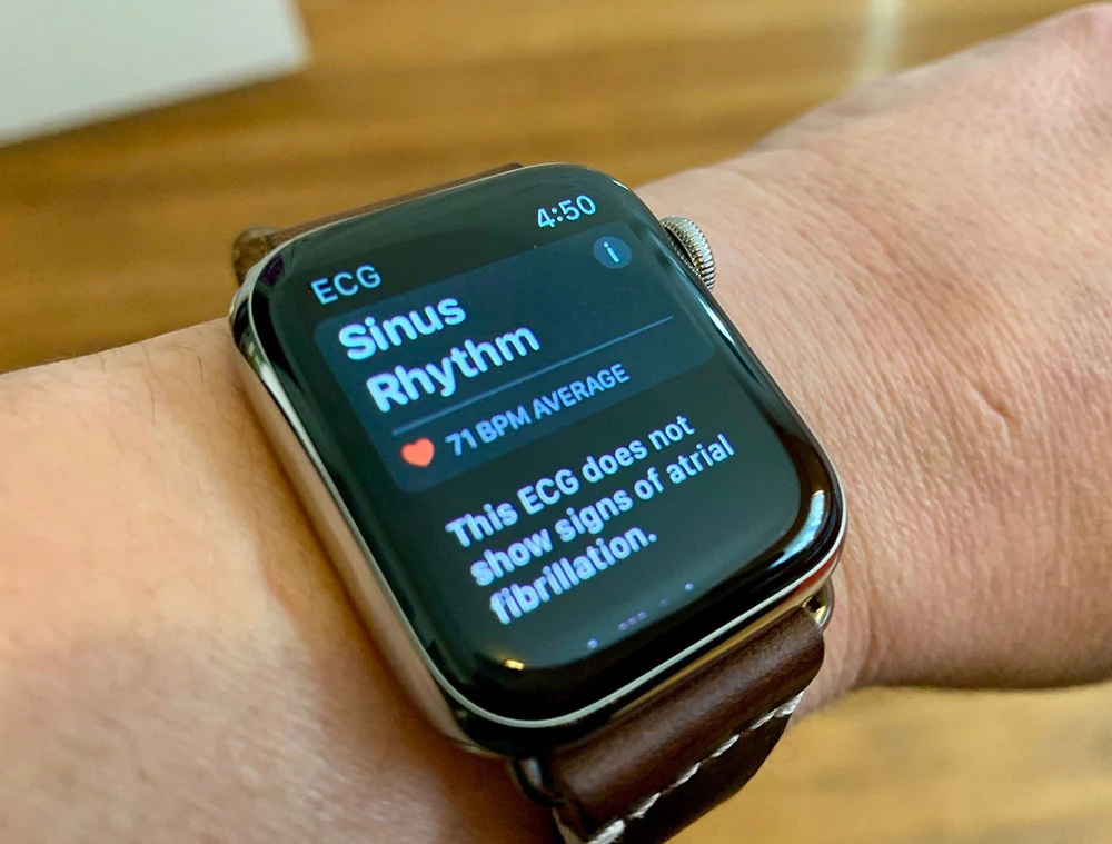 Apple Watch非侵入式血糖監測儀秘密團隊曝光
