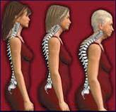 Cara Mencegah Osteoporosis.jpg