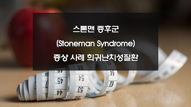 스톤맨 증후군(Stoneman Syndrome) 증상 사례 희귀난치성질환