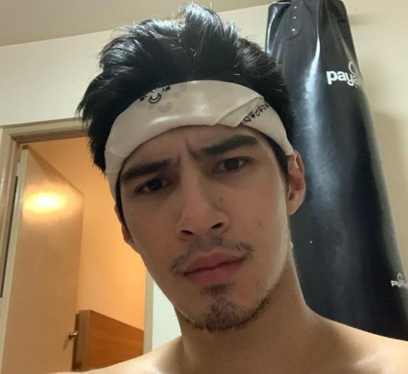 Albie Casiño expresses dismay on gov’t, blames DDS