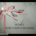 Sahut Cabaran 14 Hari Bersama Eucerin ProAcne A.I Clearing Treatment