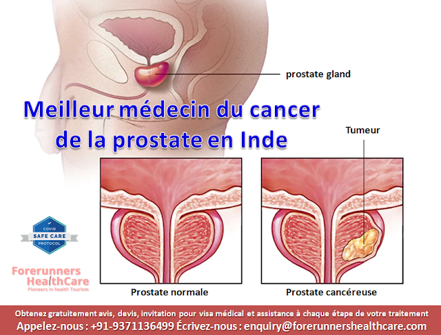 la chirurgie du cancer de la prostate coûte l'Inde