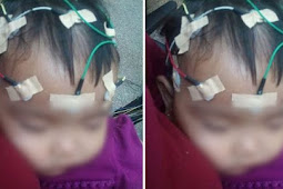 Karena Sering Dibentak orangtua, Tubuh Anak Ini Dingin, Kaku dan Linglung