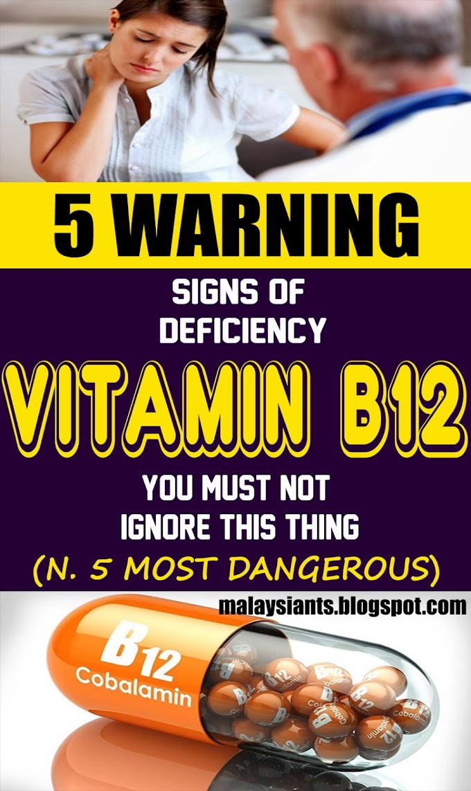 Vitamin B12 Supplement Dosage For Seniors - Vitamin B12 Recommendations - Plant Based Dietitian / I've explained the rationale for my recommendations to take vitamin b12 supplements once a week or once a day, or.