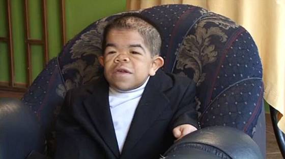 shortest man on earth. The Shortest Living Man in the