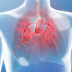 Pulmonary Hypertension, Learn About Pulmonary Hypertension Prognosis, Causes, Symptoms