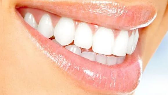 ▷ Bleaching: Wie bekomme ich weiße Zähne?