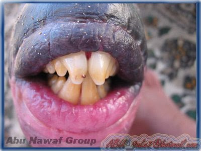 Pictures Of Lips And Teeth. Human Like Lips and Teeth