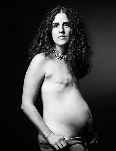 The Scar Proyect - Foto 3