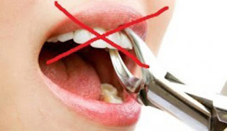 4 Cara Cepat Mengatasi Sakit Gigi karena Berlubang
