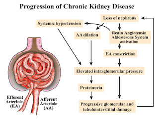 Initial stage of CKD