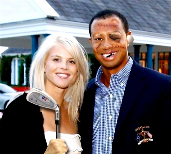 Tiger Wood Missing Teeth