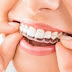 Niềng răng invisalign có tốt không? Bác sĩ tư vấn