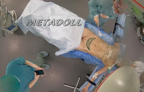 Hospital Secretly Filmed Women During Surgery (Women during operation 15)