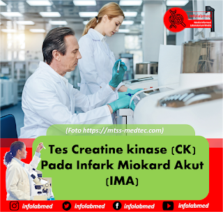 Creatine kinase,creatine kinase adalah,creatine kinase mb,creatine kinase normal,creatine kinase function,creatine kinase normal range iu/l,creatine kinase normal range u/l,creatine kinase test,creatine kinase low,creatine kinase elevation,creatine kinase isoenzymes,creatine kinase reaction,creatine kinase in dogs,creatine kinase vs creatinine,creatine kinase muscle damage,creatine kinase cpk,creatine kinase reference range,creatine kinase meaning,creatine kinase level 400,creatine kinase assay,creatine kinase low levels,creatine kinase and creatinine,creatine kinase activity,creatine kinase and statins,creatine kinase and muscle damage,creatine kinase als,creatine kinase and myocardial infarction,creatine kinase and lactate dehydrogenase,creatine kinase and exercise,creatine kinase abbreviation,creatine kinase alcohol,creatine kinase and kidney,creatine kinase after heart attack,creatine kinase and troponin,creatine kinase and heart attack,creatine kinase and mi,creatine kinase and thyroid,creatine kinase and lupus,creatine kinase athletes,creatine kinase blood test,creatine kinase blood,creatine kinase bb,creatine kinase blood levels,creatine kinase brain,creatine kinase biomarker,creatine kinase biochemistry,creatine kinase blood bottle,creatine kinase bodybuilding,creatine kinase blood test low,creatine kinase benefits,creatine kinase breakdown,creatine kinase back pain,creatine kinase brain tumor,creatine kinase baby,creatine kinase blood test results,creatine kinase becker's muscular dystrophy,creatine kinase blood test meaning,creatine kinase bb isoenzyme,creatine kinase blood test tube color