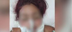 Τη φωτογραφία της γυναίκας που έπεσε θύμα ομαδικού βιασμού στο Ζεφύρι και νοσηλεύεται σε κώμα στο νοσοκομείο έφερε στο φως της δημοσιότητας ...
