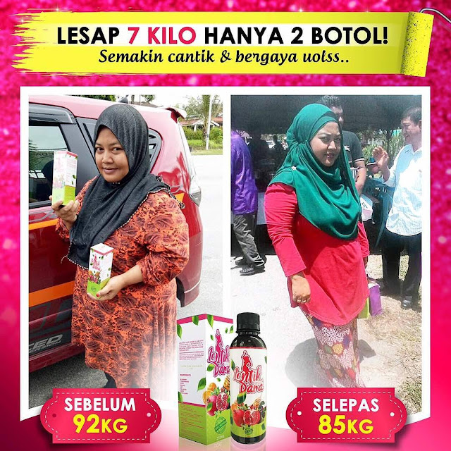 Testimoni Jus Lentik Dara