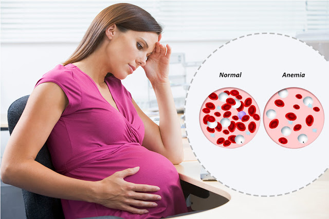 Learn the risk factors for anemia Complications of anemia | healthy care
