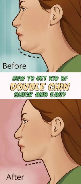 How to Get Rid of a Double Chin the Quick and Easy Way