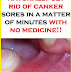 How To Naturally Get Rid Of Canker Sores In Minutes With No Medicine!