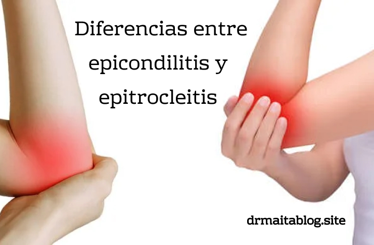 Diferencias entre epicondilitis y epitrocleitis