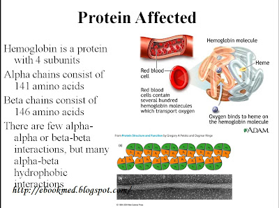 Sickle Cell Anemia Powerpoint Presentation Free Download